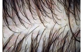 Hair & Scalp Analysis at Sacred Remedy